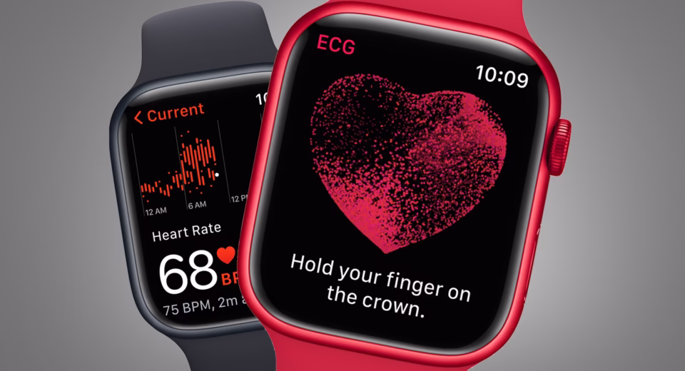 apple watch series 12 glucose monitoring delay